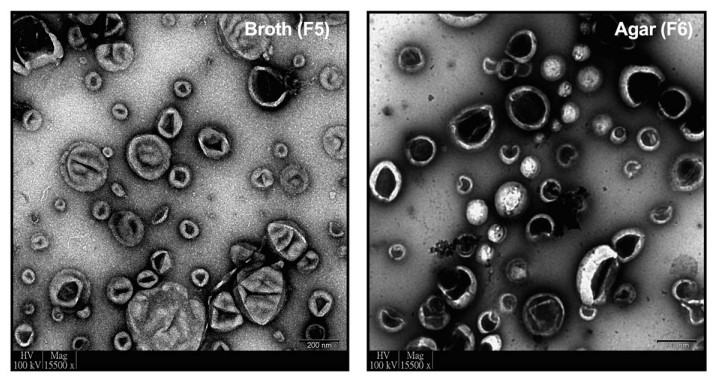 Transmission electron micrograph of Candida auris-derived exosomes obtained by broth culture and agar culture. (Chan, et al., 2022)