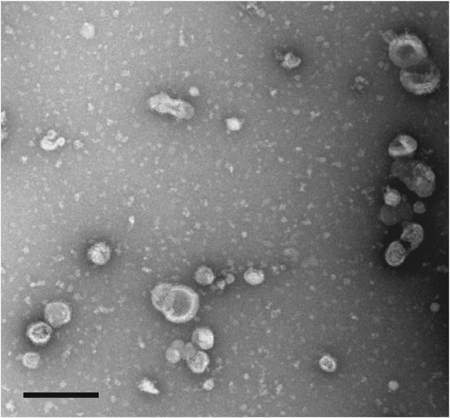 TEM of the secreted nanovesicles. (Marshall, et al., 2018)