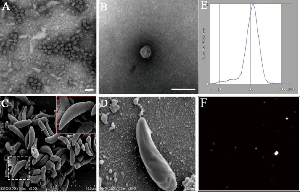 Fig. 1 Physical characterization of Neospora-derived exosomes. (Li, et al., 2018)