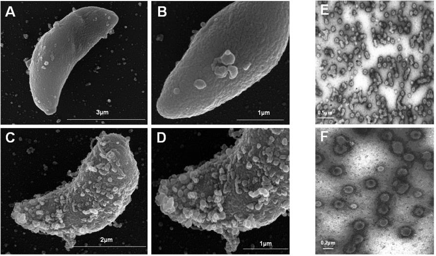 Fig. 1 Characterizations of Toxoplasma shedding exosomes. (Silva, et al., 2018)