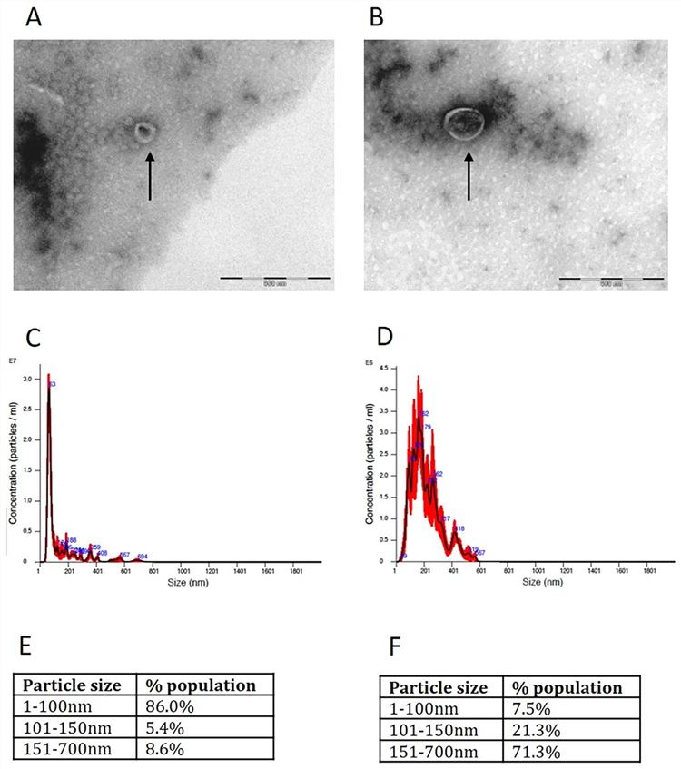 Characterization of Giardia lamblia EVs. (Faria, et al., 2023)