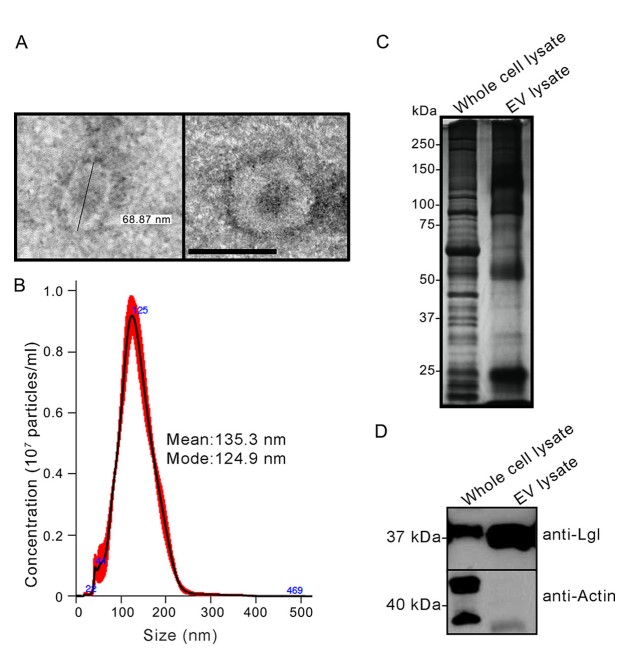 Fig. 1 Characterization of Entamoeba exosomes. (Sharma, et al., 2020)