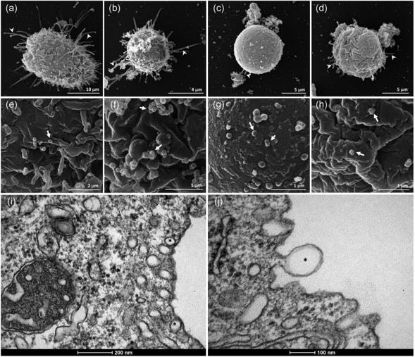 Fig. 2 Electron micrographs of exosomes generated from Acanthamoeba trophozoites. (Costa, et al., 2021)