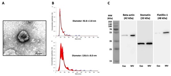 Fig. 1 Characterization of Plasmodium-derived extracellular vesicle subpopulations. (Vimonpatranon, et al., 2022)