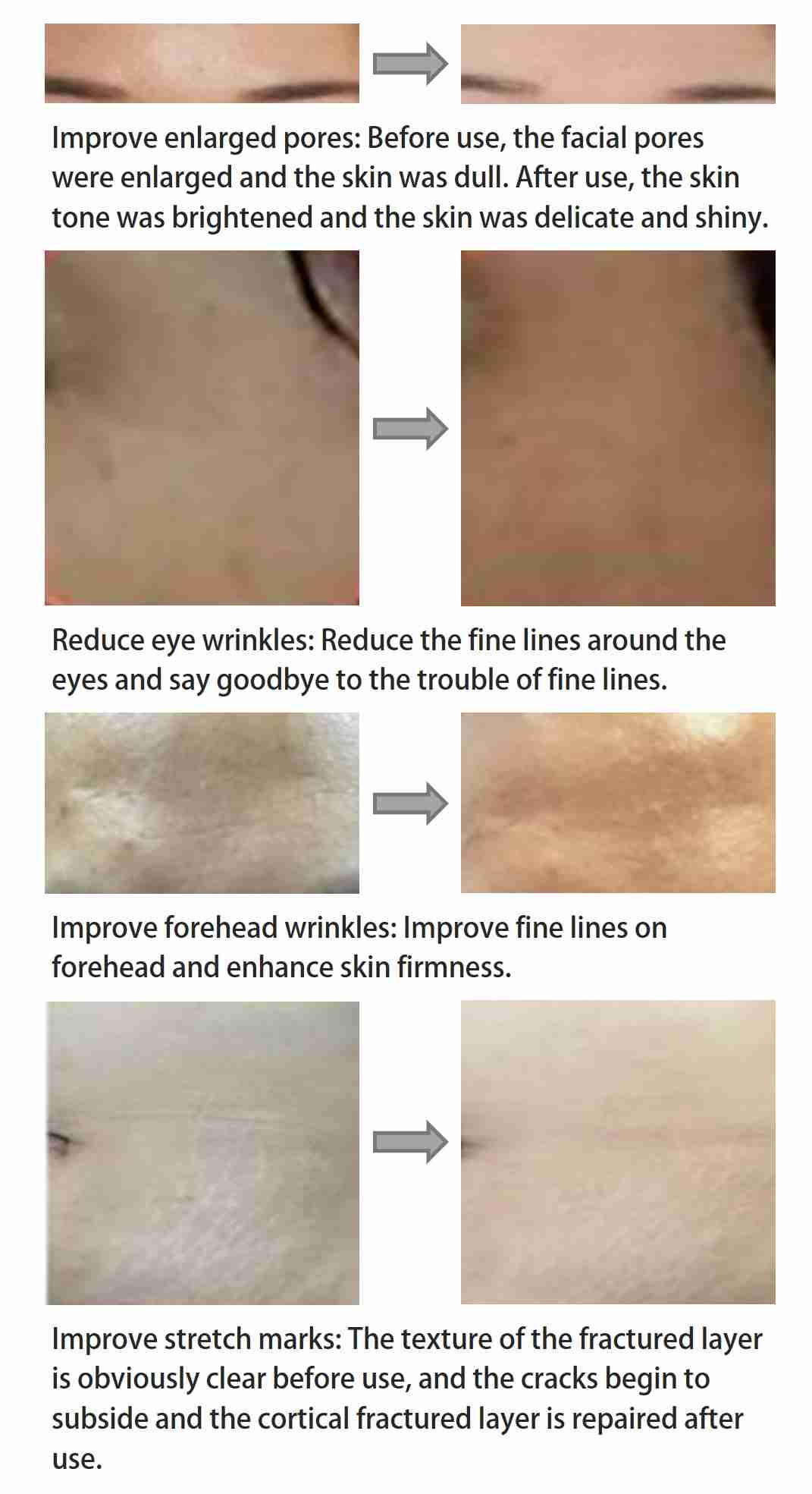 Fig.1 UCMSC exosomes address skin problems. (Creative Biolabs Original)