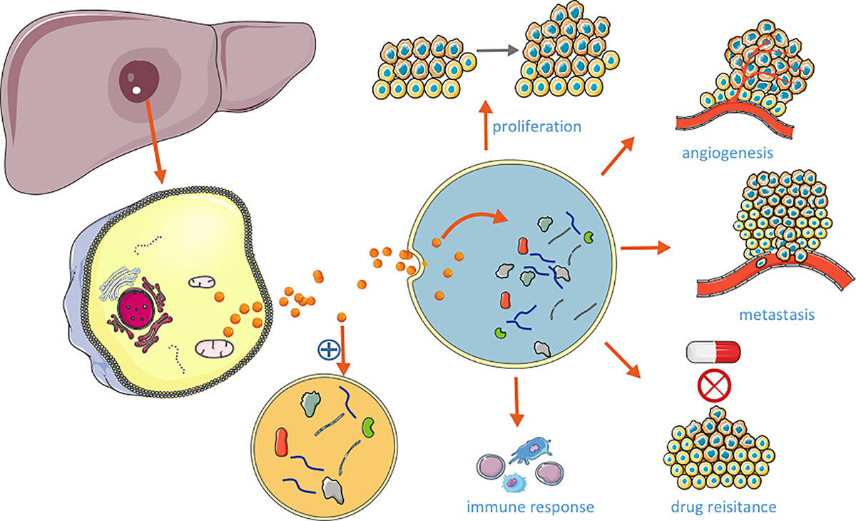 Function of HCC-derived exosomes. (Li, et al., 2022)