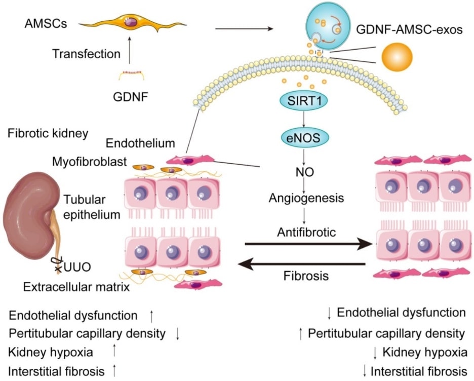 GDNF-AMSC-exos have the potential to improve kidney damage. (Chen, et al., 2020)