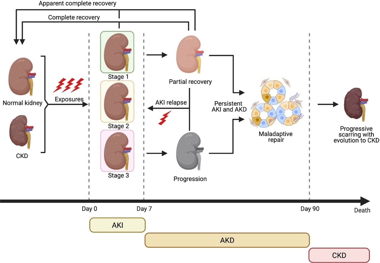 Evolution of AKI to CKD. (Quaglia, et al., 2022)