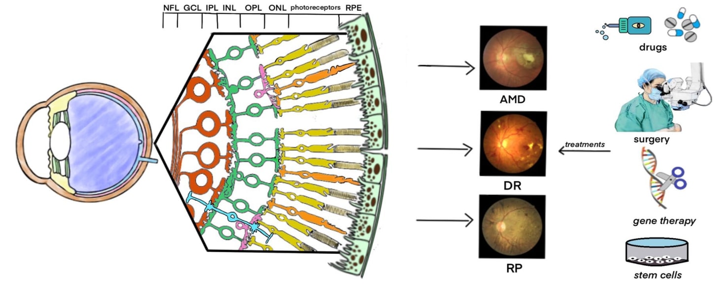 Retinal disorders and treatments.