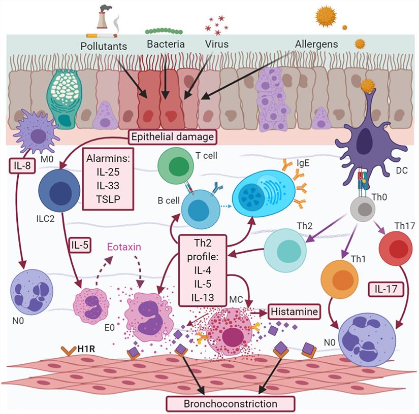 Asthma development mechanism. (Pavón-Romero, et al., 2021)