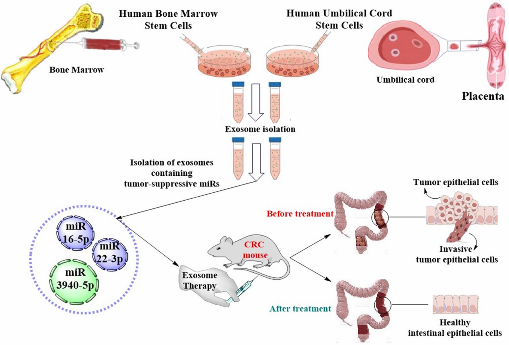 Potential CRC therapy using tumor-suppressive miRs in MSC-derived exosomes. (Guo, et al., 2022)