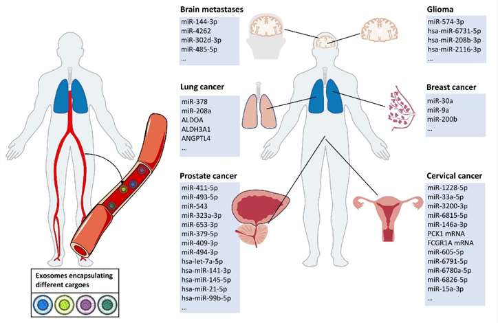 Changes of exosomes in tumor radiotherapy. (Shi, et al., 2022)