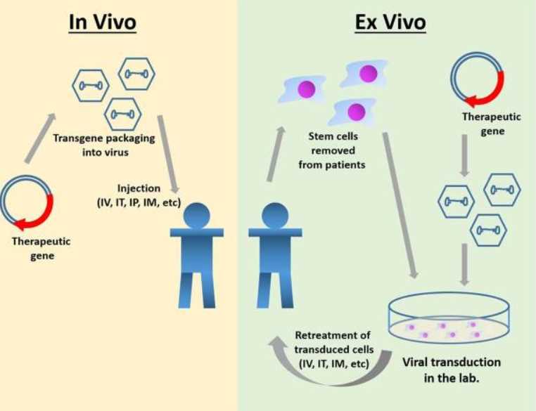 Gene therapy for MPS IIIA.