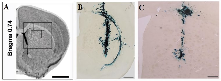 In the striatum and external capsule (A), positive β-galactosidase staining was observed in brains injected with either the Mokola (B) or VSV-G (C) vector.