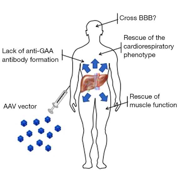 Schematic of investigational liver-directed gene therapy for Pompe disease.