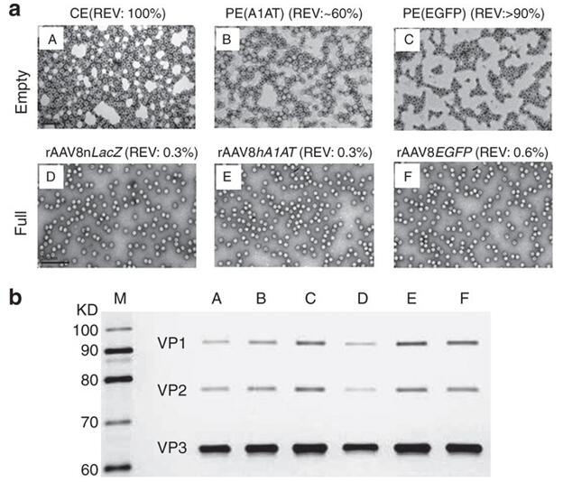  Efficient removal of empty virions from rAAV8 preparations by CsCl gradient centrifugation. 