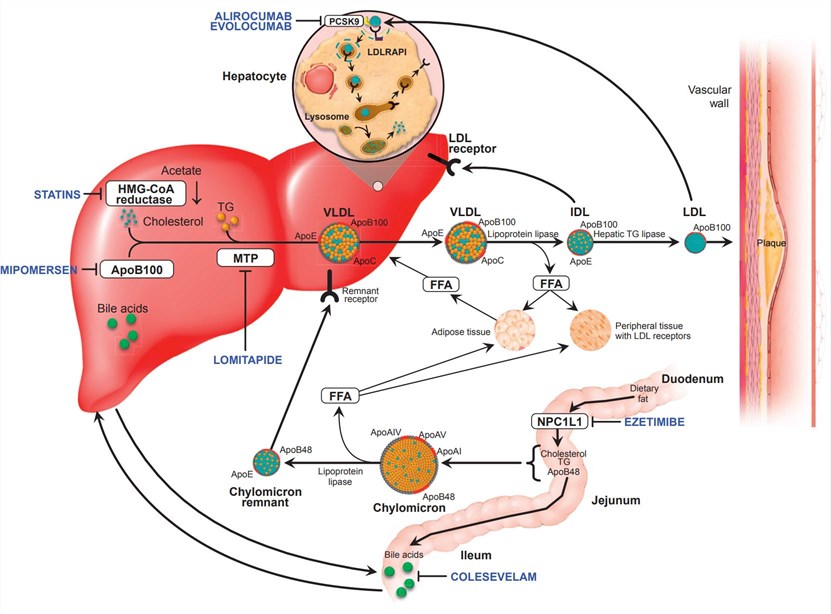 Familial hypercholesterolemia.