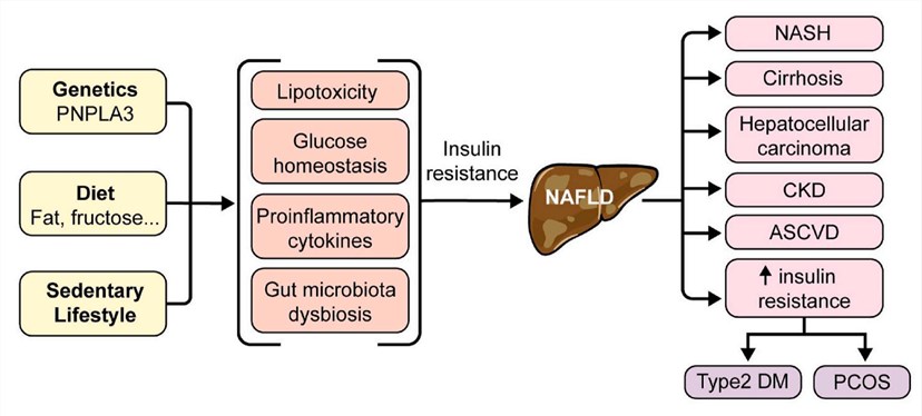 The Influencing Factors of NAFLD and Its Possible Consequences.