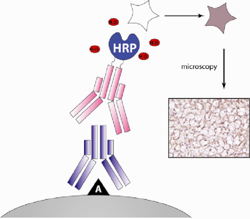 Schematic representation of immunohistochemistry (Jensen, 2012)