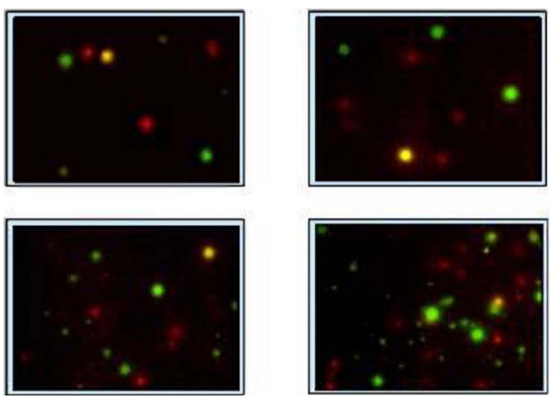 Fig.3 Dual-color fluorospot for the detection of IL-2 and/or IFN-γ-producing cells. (Gazagne, et al., 2005)