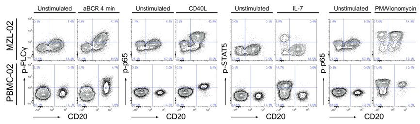 Fig.1 Phospho-specific flow cytometry for detecting aberrant signaling in B-cell lymphomas. (Blix, et al., 2012)