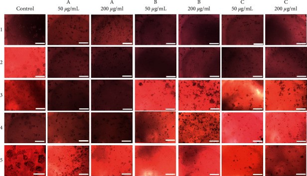 Fig.2 Microscopic observations of HepG2 after incubation. (Thusyanthan, J., et al., 2022)