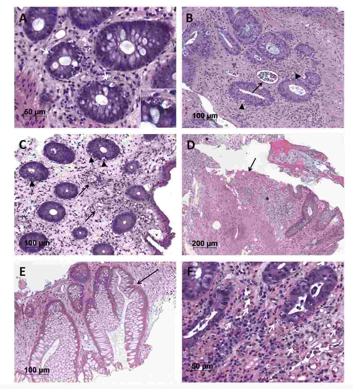 GVHD Histomorphological Parameters Analysis. (Hippe, Katrin, et al., 2023)