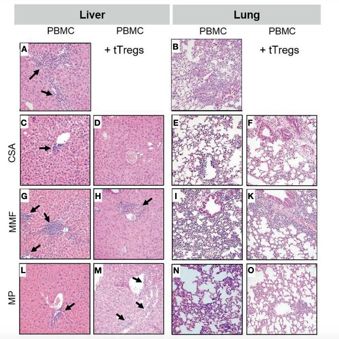 Histopathologic Changes of Liver And Lung in PBMCs or GVHD Therapy. (Landwehr-Kenzel, Sybille, et al., 2021)