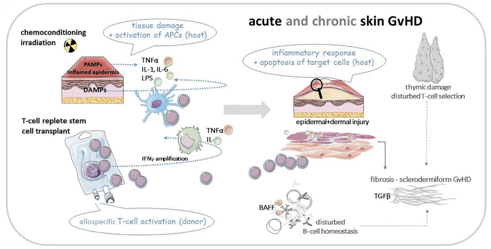 Cartoon of Basic Pathomechanisms in Acute And Chronic GVHD of The Skin. (Link-Rachner, Cornelia S., Katja Sockel, and Catharina Schuetz, 2022)