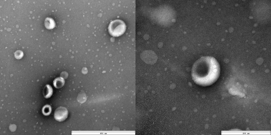 Case study-TEM image of liposomes. (Creative Biolabs Original)