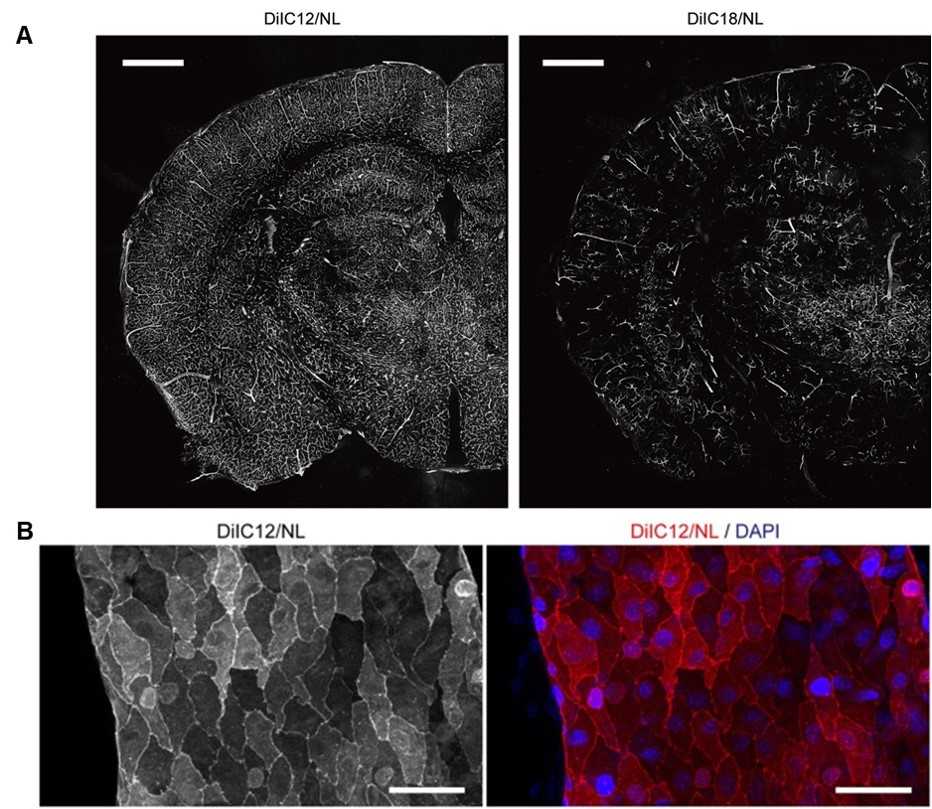 Confocal micrographs. (Konno, Alu, Naoya Matsumoto, and Shigetoshi Okazaki, 2017)