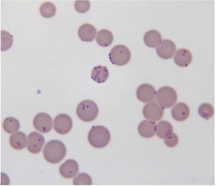 Mycoplasma