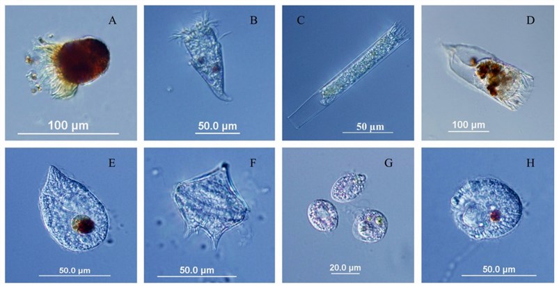 Microscopy images of several protozoa species.