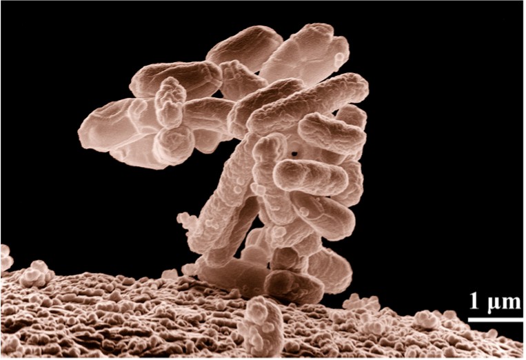 A cluster of Escherichia coli bacteria magnified 10,000 times. (Wikipedia)