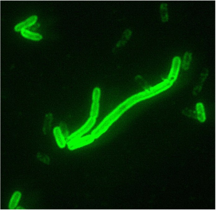 Y. pestis seen at 200× magnification with a fluorescent label.