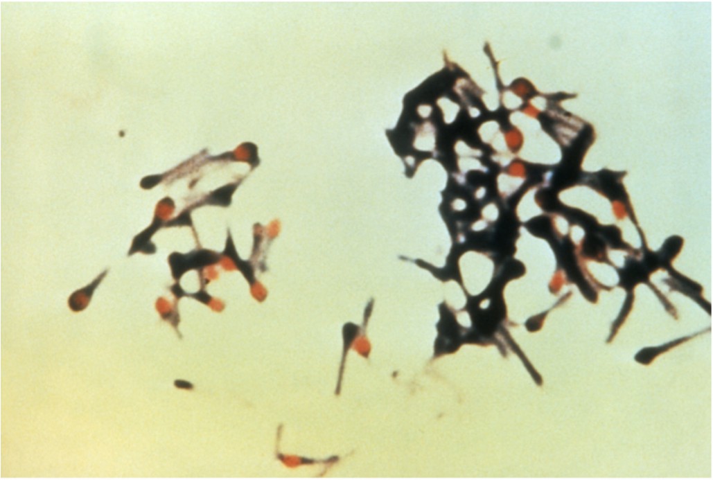 Clostridium tetani forming spores.