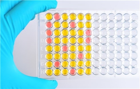 Fig.1 Troubleshooting for ELISA. (Creative Biolabs Authorized)