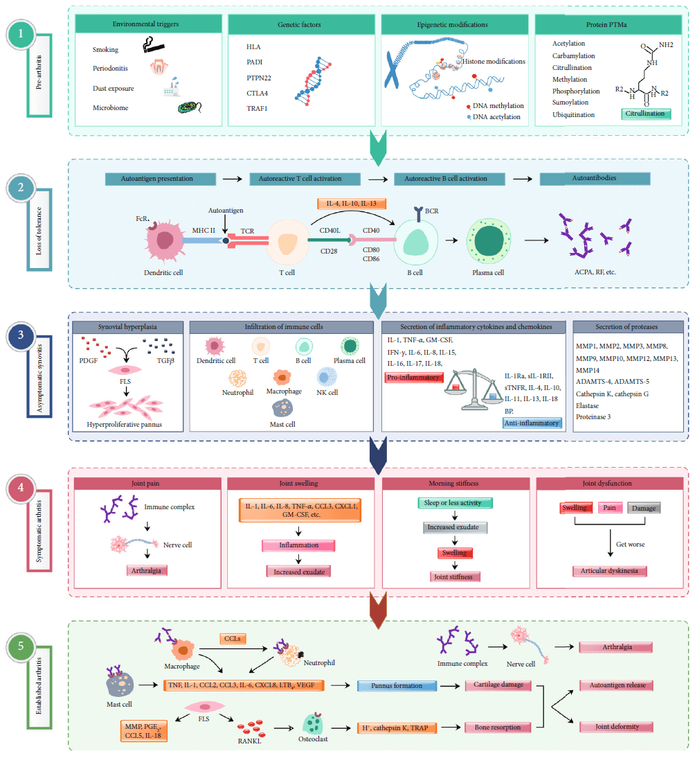 Different phases in RA pathogenesis.