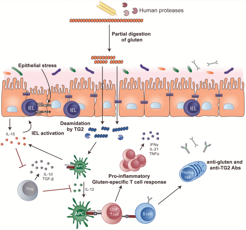 Fig.1 Pathogenesis of celiac disease. (Tye-Din, Heather and Daniel, 2018)