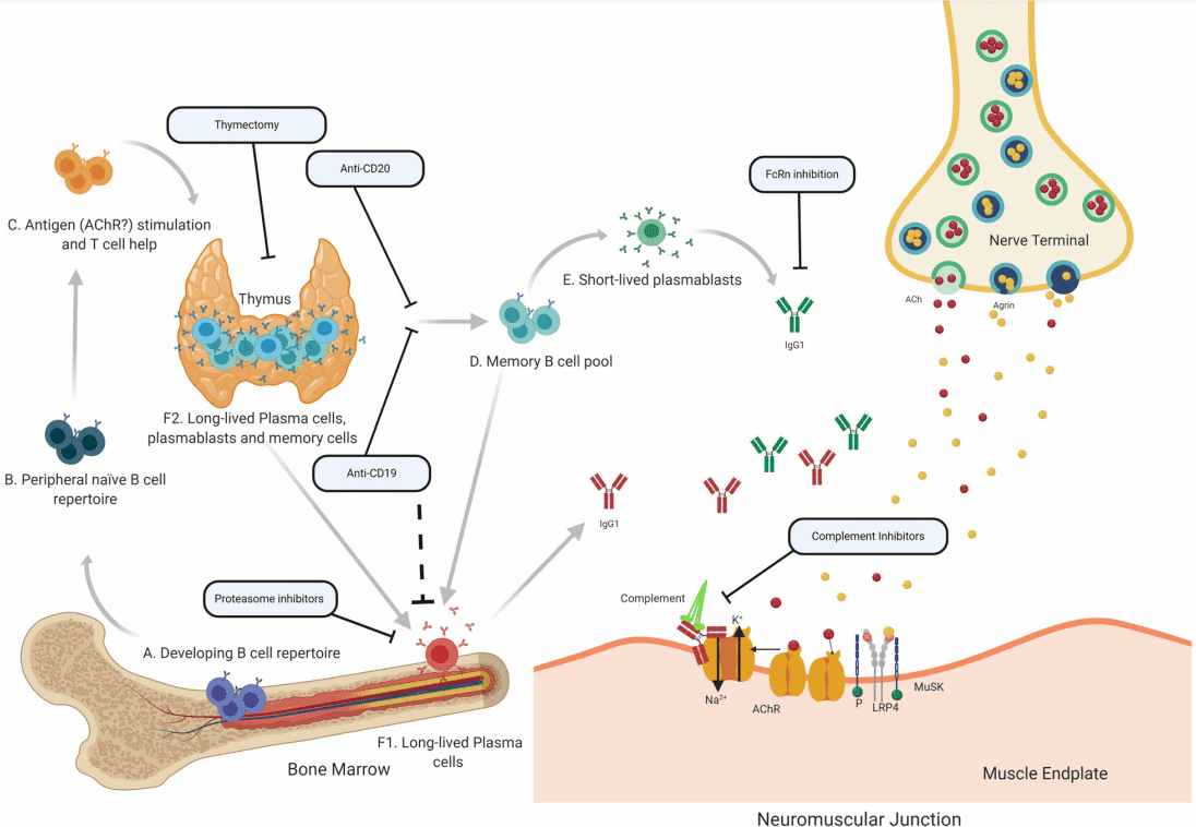 Fig.1 Autoimmune pathology in AChR MG. (Fichtner, et al., 2020)