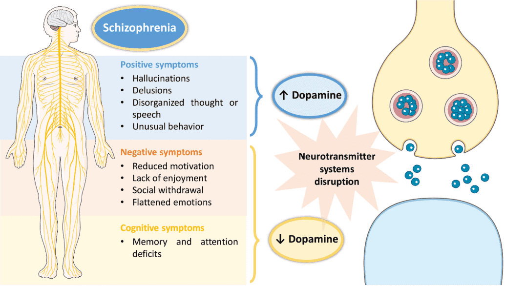 Fig.1 Schizophrenia pathophysiology. (Pires, Ana and Francisco, 2022)