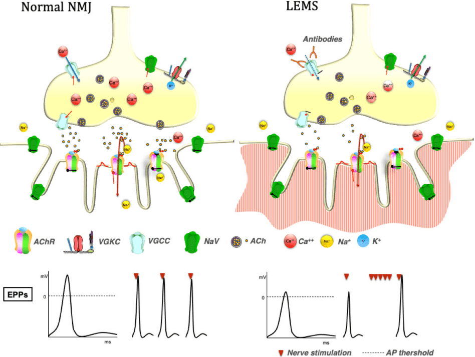 Fig.1 Pathophysiology of LEMS. (Giannoccaro, Patrizia and Rocco, 2021)