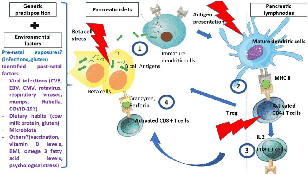 Fig.1 Pathogenesis of type 1 diabetes. (Houeiss, Sandrine and Christian, 2022)