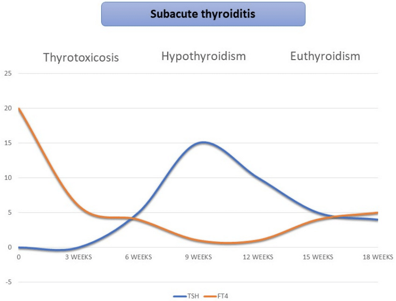 Fig.1 Clinical course of subacute thyroiditis. (Lanzo, et al., 2022)