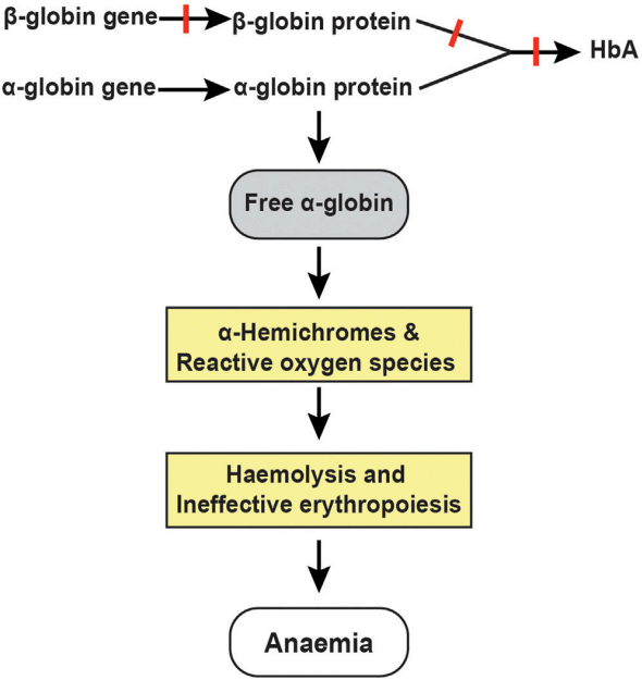 Fig.1 Complications and pathophysiology of β-thalassemia. (Mettananda, 2021)