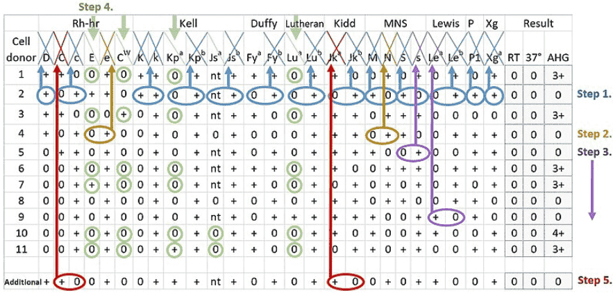 Fig.1 Detection process for antibodies to the human blood group system, including Kidd. (https://commons.wikimedia.org/wiki/File:Serology_interpretation_of_antibody_panel_for_blood_group_antigens.jpg)