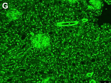 Fig.1 SMA immunofluorescence pattern on rodent kidney. (Beretta-Piccoli, Giorgina and Diego, 2022)