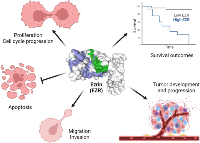 Fig.2 Ezrin in tumorigenesis. (Lipreri, Hugo and João, 2023)