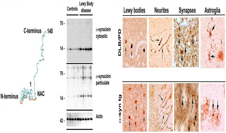 Biochemical structure of α-synuclein and its distribution in neurodegenerative diseases.