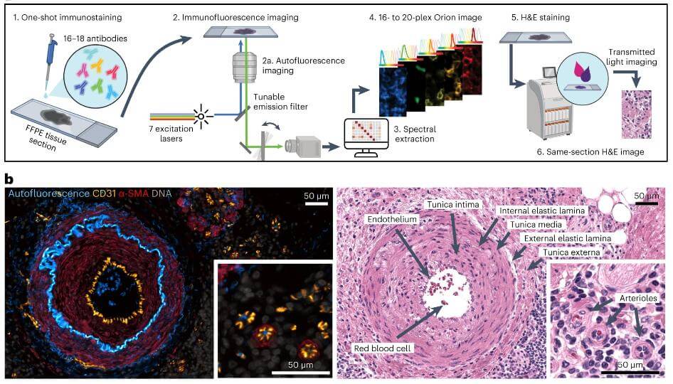 Fig.1 IF and H&E. (Lin, et al., 2023)